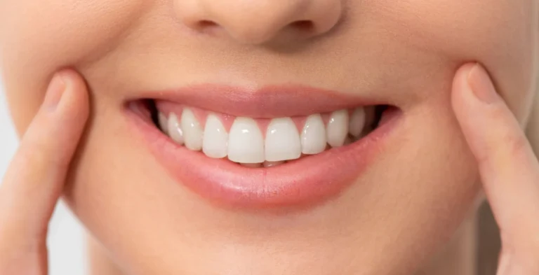 safe teeth whitening treatment