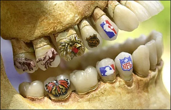 Custom Tooth Art