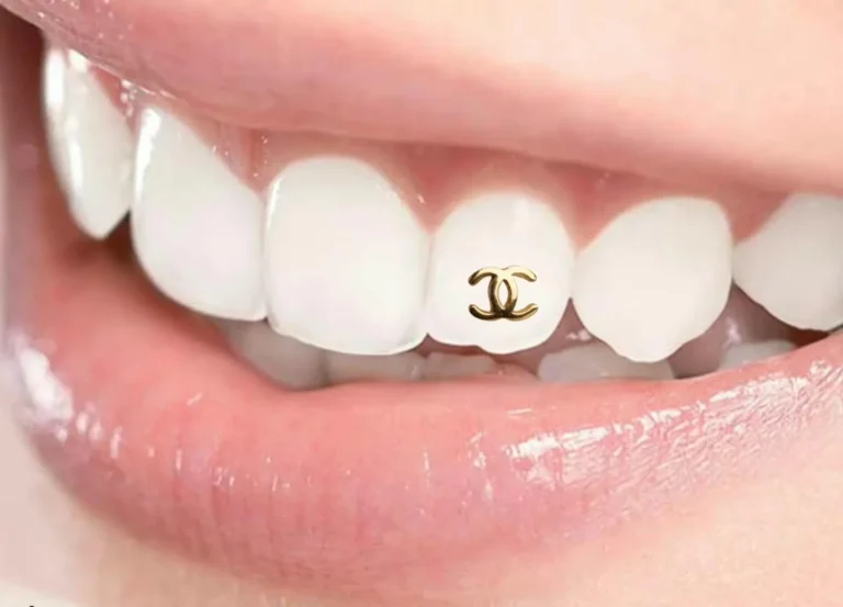 Luxury smile jewelry