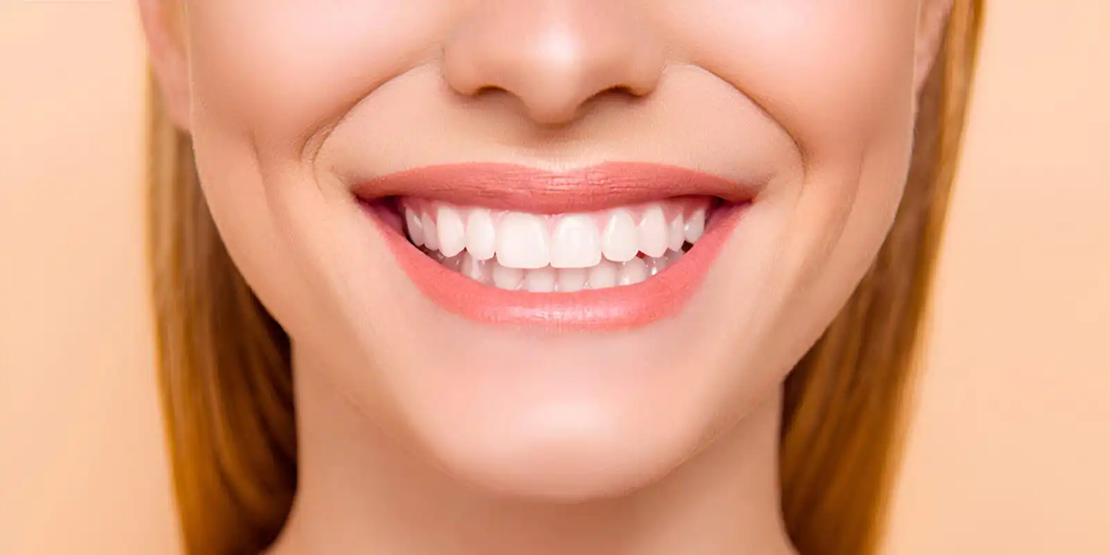 Artistic Smile Enhancements