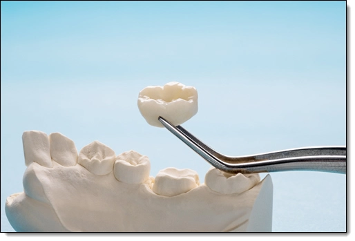 advanced dental craftsmanship