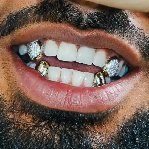 Fixed grillz teeth