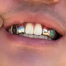Fixed grillz teeth