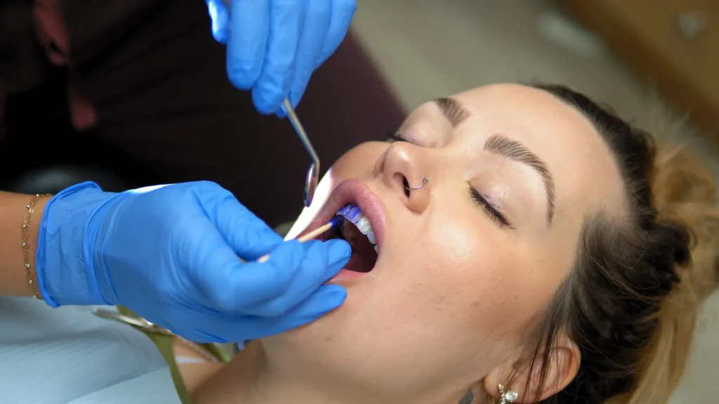 Dental Veneers Dubai