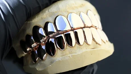 Custom Tooth Grillz