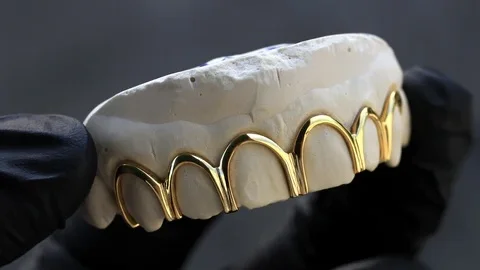 Custom Tooth Grillz