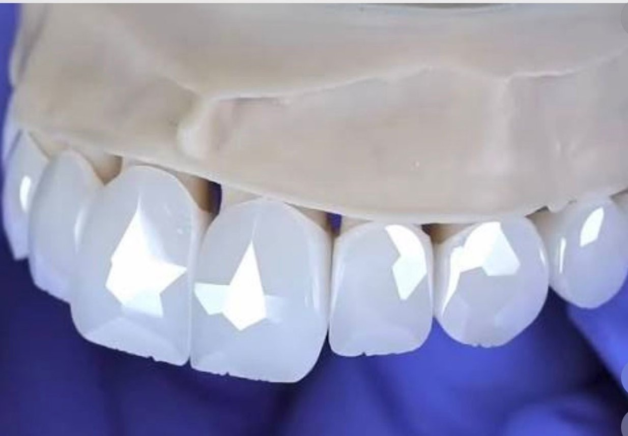 Permanent Grillz