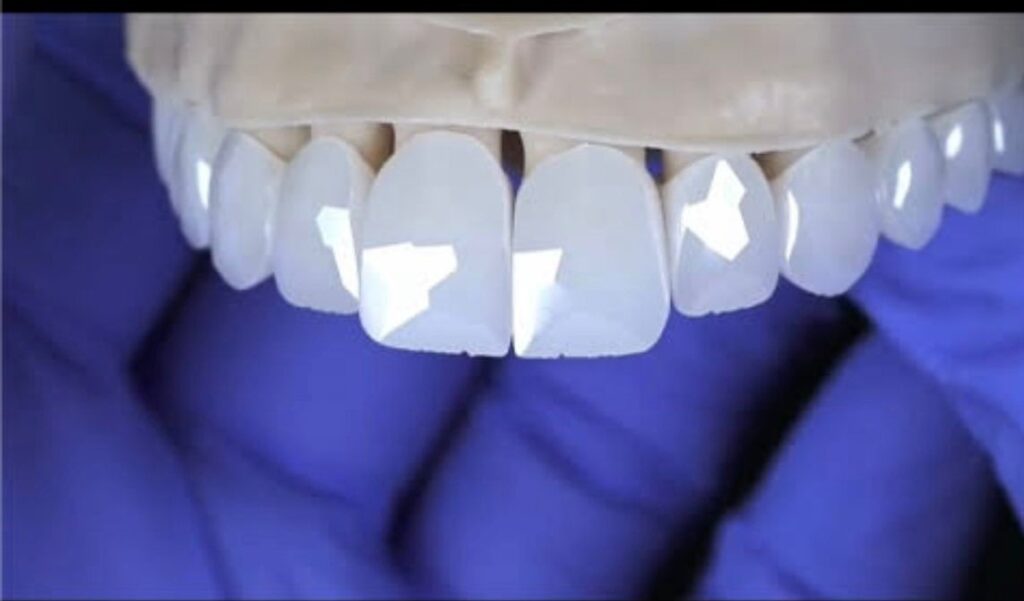 Celebrity Grillz Dubai