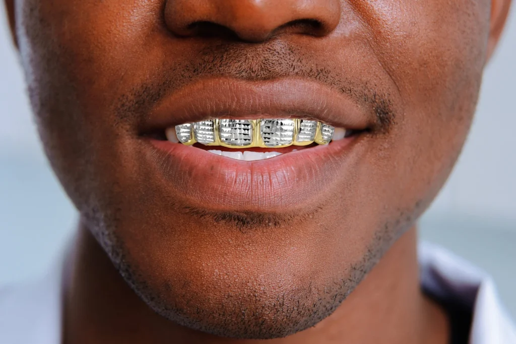 high-end fixed grillz