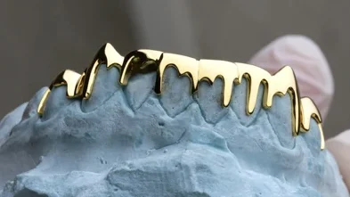 custom grillz clinic