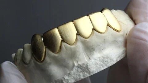 custom grillz clinic