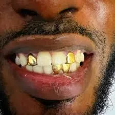 custom fixed grillz