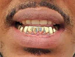 custom fixed grillz