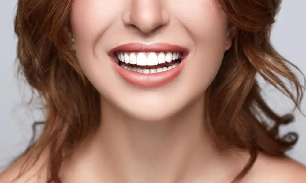 Smile Veneers Dubai