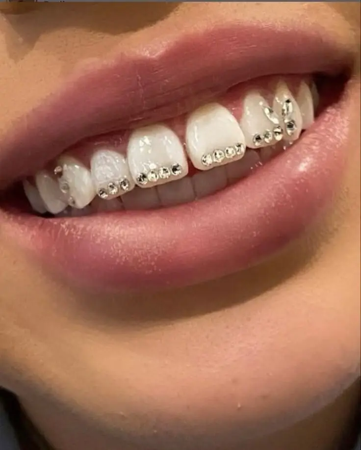 Dental Tooth Gems