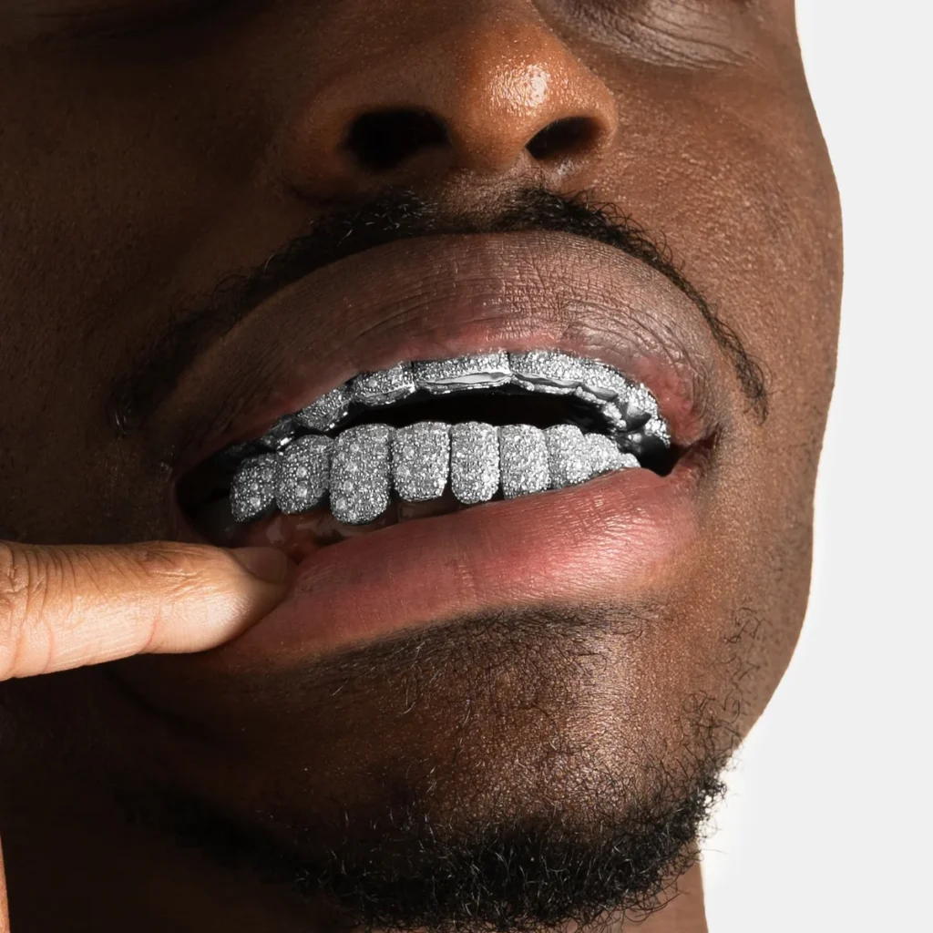 Diamond Grillz vs Moissanite
