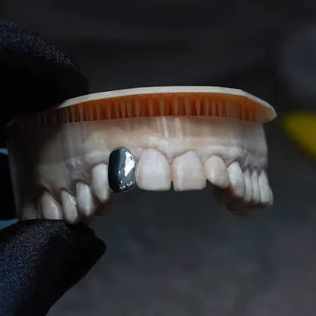Removable Grillz