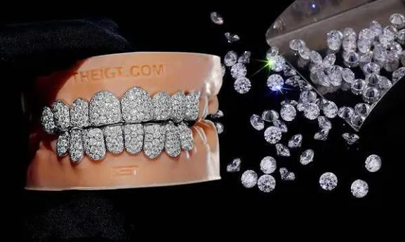 Diamond Grillz vs Moissanite