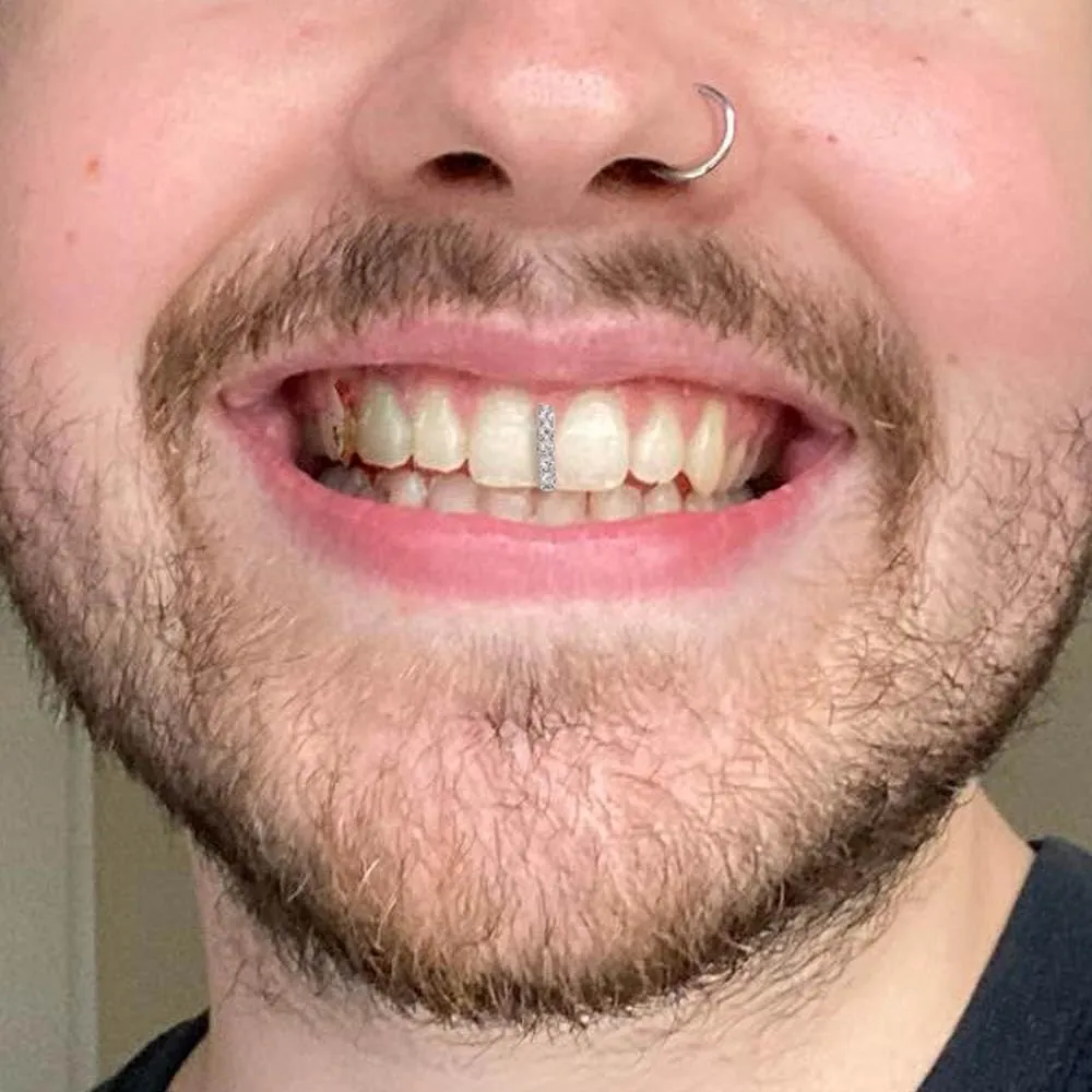 Grillz for Gap Teeth
