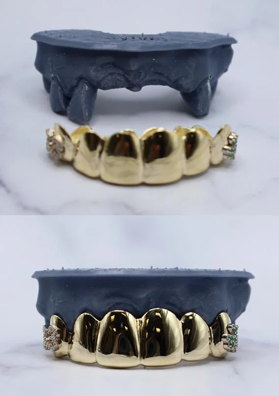 Grillz for Missing Teeth