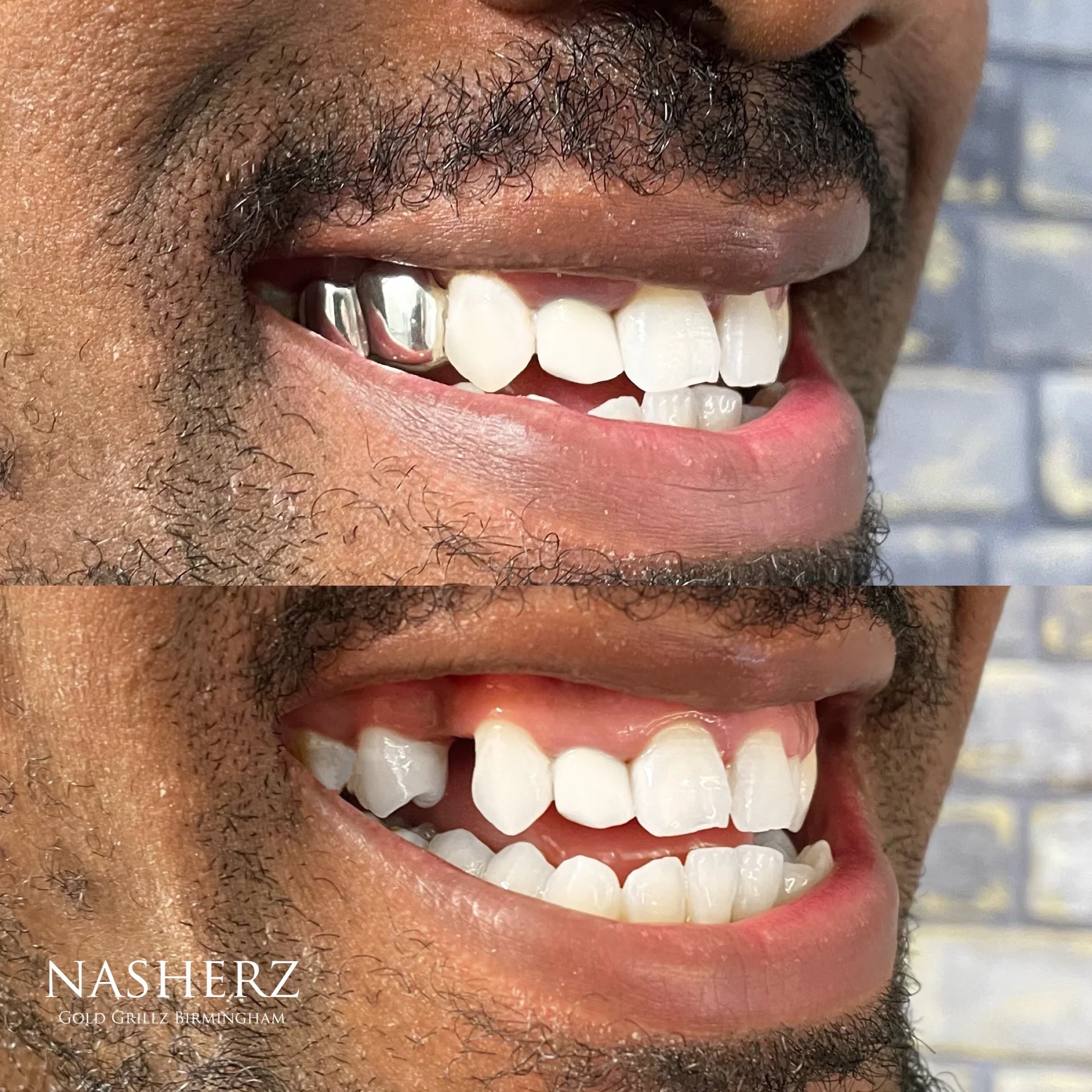 Grillz for Missing Teeth