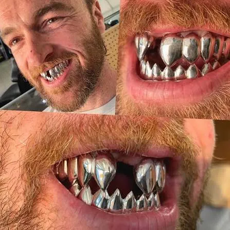 Shark teeth grillz