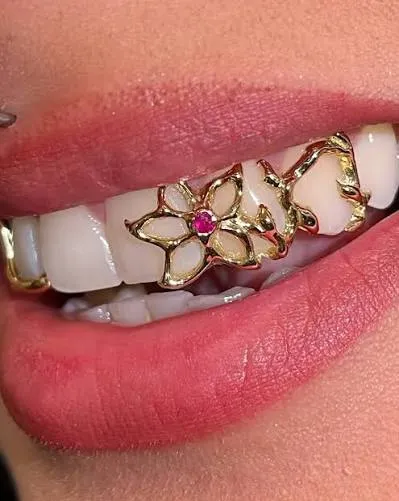 wedding grillz