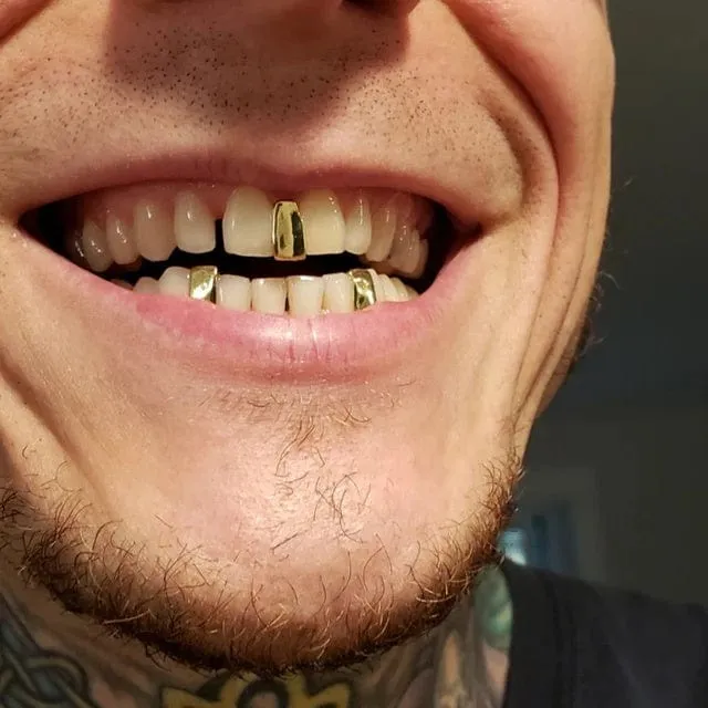 Grillz for Gap Teeth