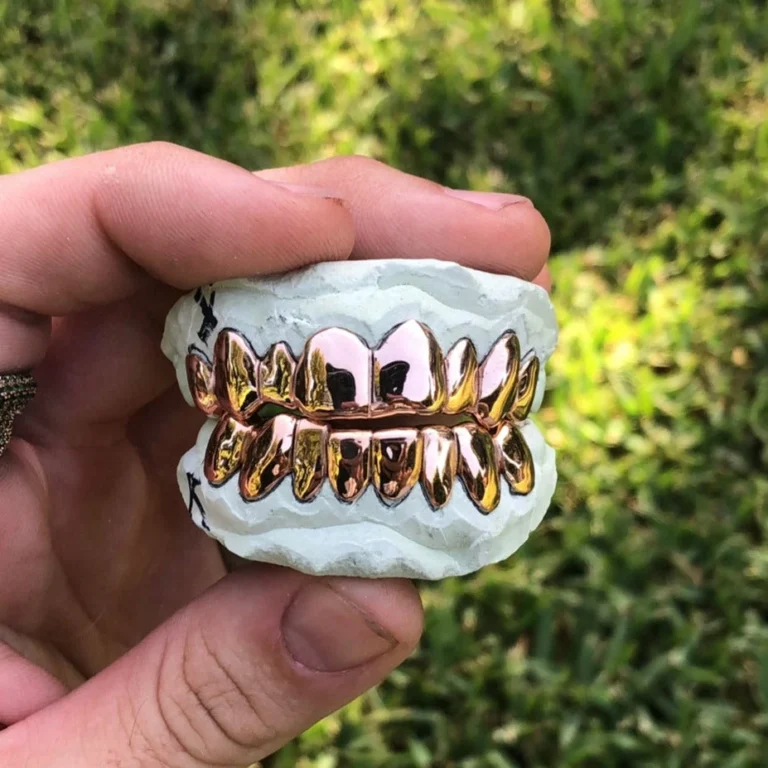 Rose Gold Grillz
