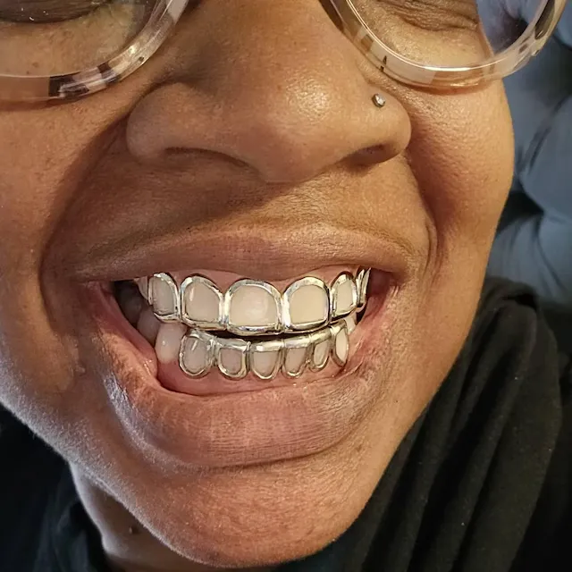 Open Face Grillz