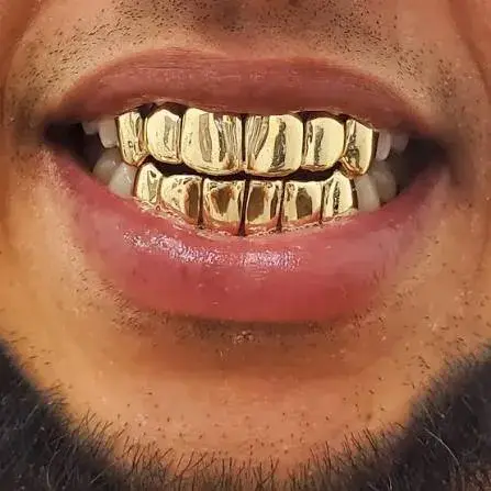 Solid Gold Grillz
