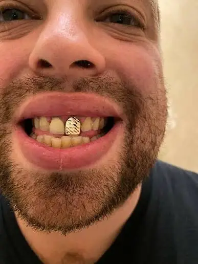 Single Tooth Grillz