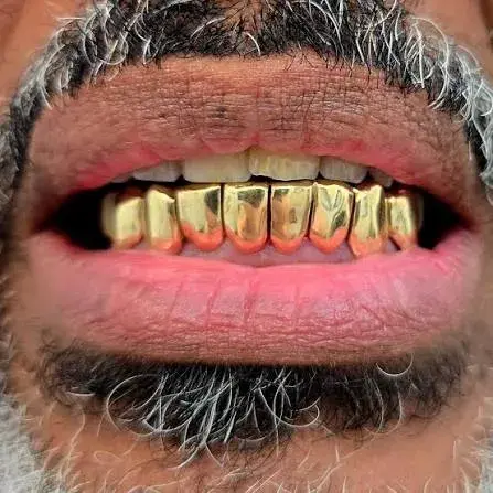 Solid Gold Grillz