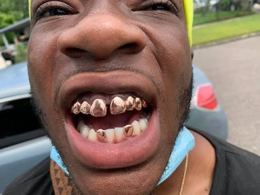 rose gold grillz custom diamond teeth grillz in Dubai