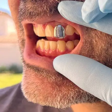 Single Tooth Grillz