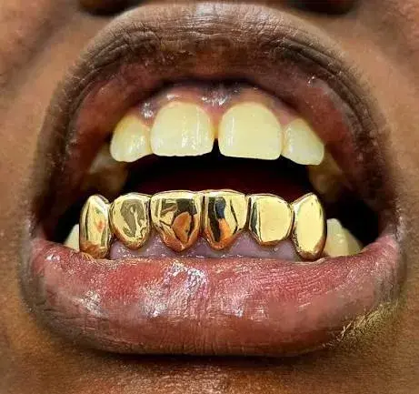 Solid Gold Grillz
