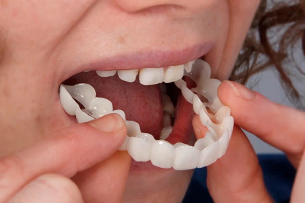 Teeth Cover Dubai