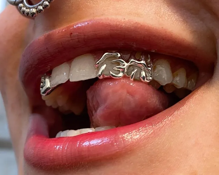 Custom Grillz Turnaround Time
