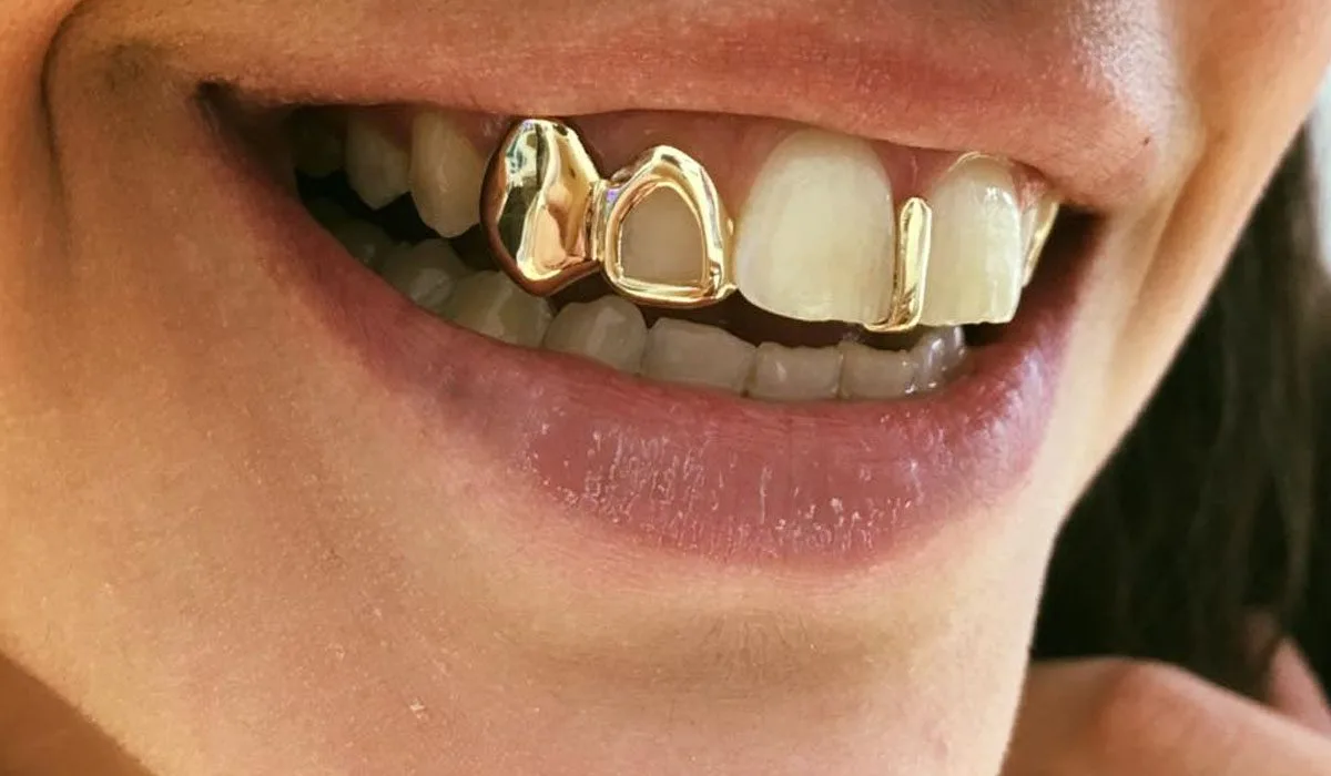 How to Know If Grillz Fit Properly: Signs & Fixes