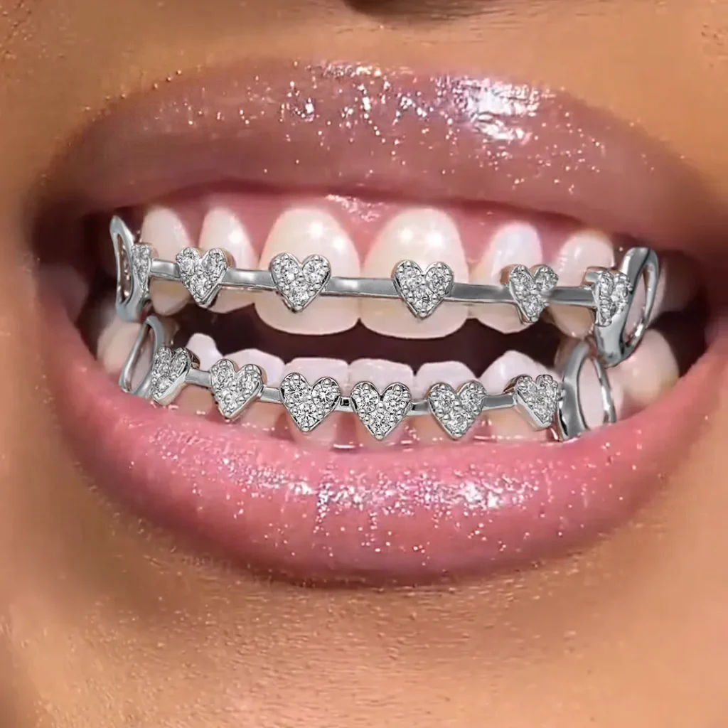 grillz with braces custom dental jewelry