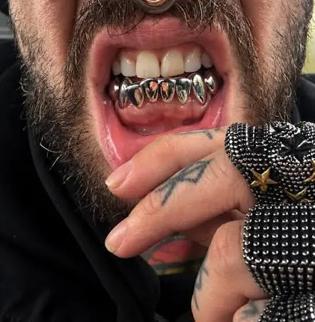 Platinum Dental Jewellery