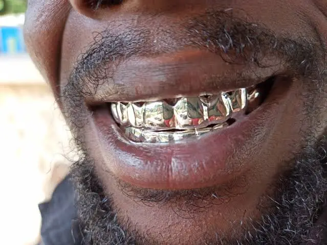 Platinum Dental Jewellery