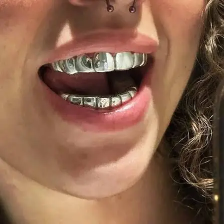 Platinum Dental Jewellery