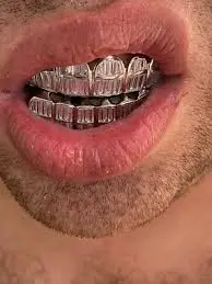 baguette grillz with custom diamond teeth design in Dubai